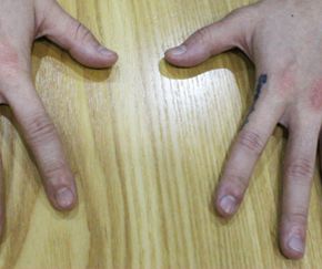 25세 남성 · 4개월 경과